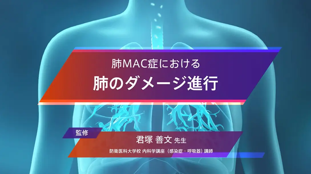 【Insmed】疾患進行イメージ動画(医療者向け)_240802